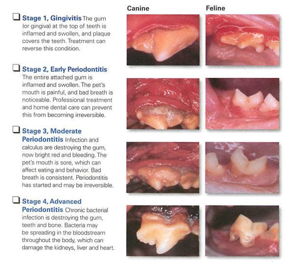 Here's What You Need to Know About the Stages of Periodontal Disease ...